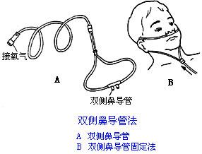 ◆肺病患者如何家庭氧療？